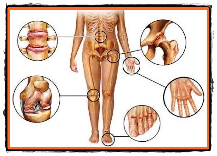 Principalele simptome ale artrozelor
